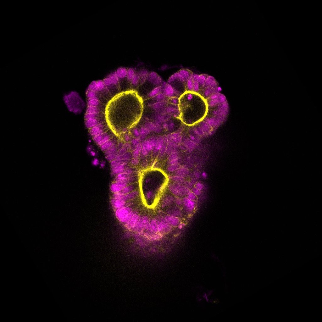 Gut organoids in Halloween mood 🎃 👻 
#HappyHalloween #MicrosCreepy