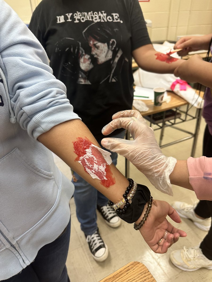 🎉 Exciting times in Ms. Bly’s Sports Med I class! Students dived into the integumentary system by creating fake wounds in the Halloween spirit. 🩸✨ They also explored the fascinating wound healing process. Learning has never been this fun! 
#SportsMedI 
#LTHSStrong