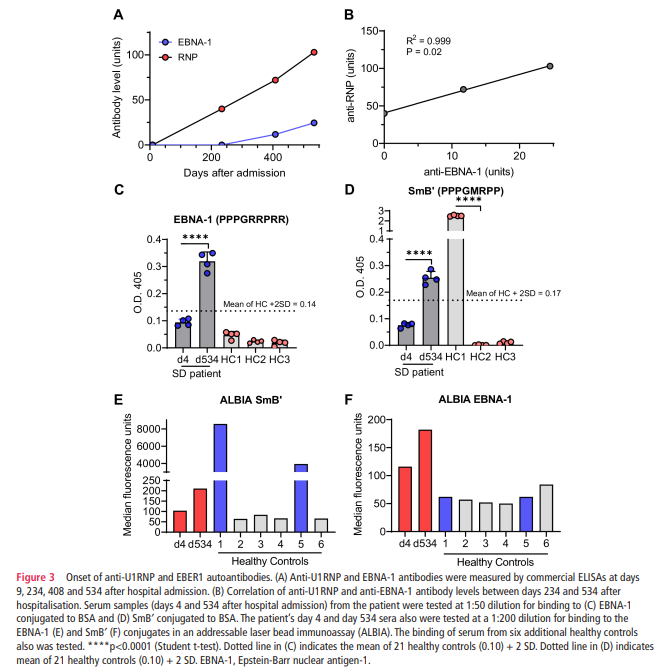 eular_ARD's tweet image. 🕵️  Unraveling the role of primary #EBV infection in developing #SjogrenDisease 

📅 Anti-Ro52 and anti-Ro60 present 7 days after infection underwent IgM➡️IgG switching
📈 7 months later, Abs EBNA1 &amp;amp; Abs U1RNP appeared concomitantly▶️ #molecularmimicry

🔗 bit.ly/48J7zDr