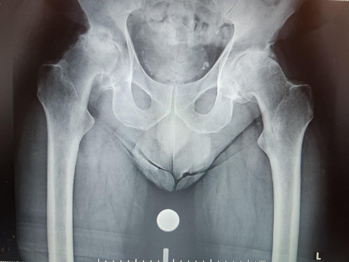 Deepu Bhaskar tweet media