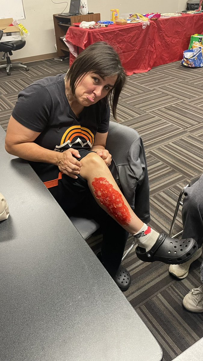 Happy Halloween everyone! This week’s training was very on theme, with all the different injuries our members had dressed up as it sure was an entertaining night👻🎃
#stjohnambulance #firstaid #spookyseason #happyhalloween