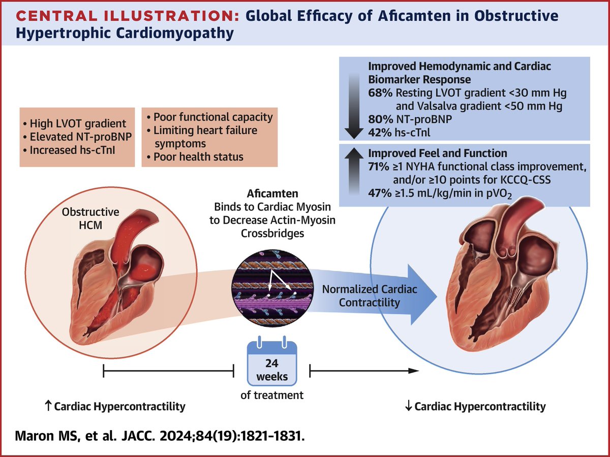 JACC Journals (@jaccjournals) on Twitter photo Ready for #aficamten, a next-in-class myosin inhibitor for oHCM? See the results: bit.ly/3Byamm0
#JACC #cvHCM #SEQUOIA <a href="/MartinMaronMD/">Martin Maron, MD</a> @JJheart_doc <a href="/matthewmylee/">Matthew MY Lee</a> Ready for #aficamten, a next-in-class myosin inhibitor for oHCM? See the results: bit.ly/3Byamm0
#JACC #cvHCM #SEQUOIA <a href="/MartinMaronMD/">Martin Maron, MD</a> @JJheart_doc <a href="/matthewmylee/">Matthew MY Lee</a>
