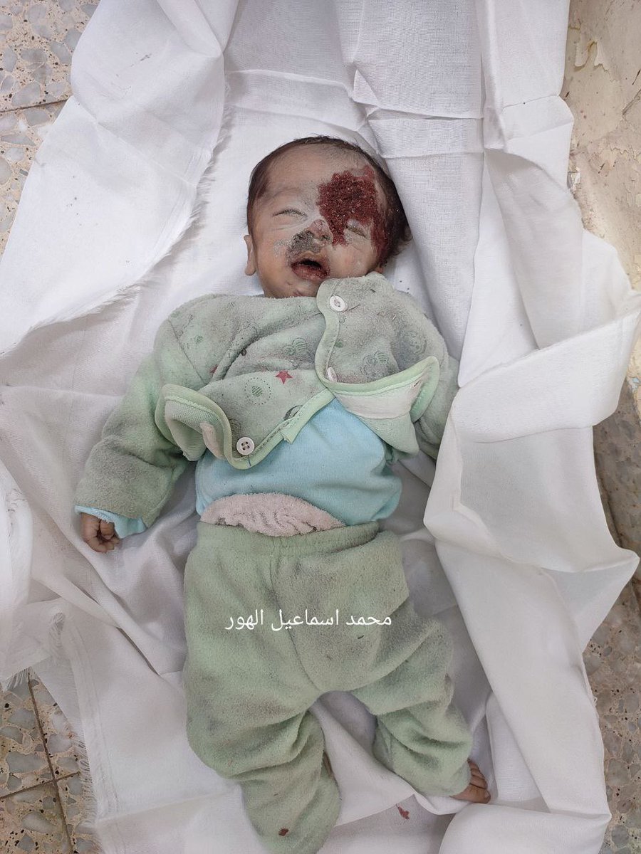 gazanotice's tweet image. His name was Tamer Adel Mohsen. He was only 5 months old. Just moments ago, he lost his life along with his mother in an Israeli attack.

When Tamer was born, he was given his father’s name. His father had died in an Israeli attack weeks before Tamer came into the world, unable…