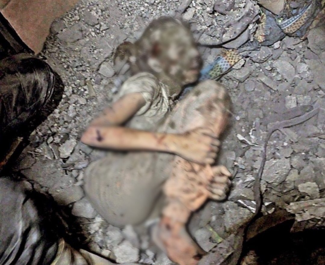 Korku içinde kendini sıkarak enkaz altında kalıp şehit düşen Gazzeli bir çocuk..

- Bu çocuk sessiz kalanlardan şikayetçi olacak..