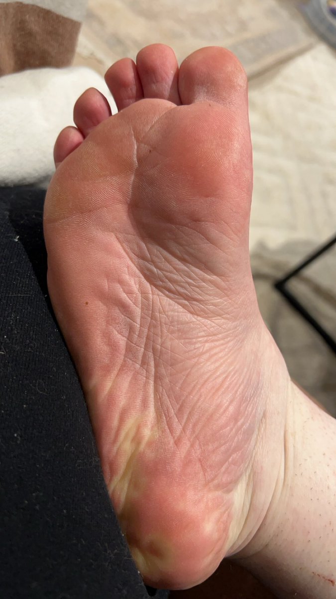LRNymeria's tweet photo. Where’s my little sissy foot slaves who want to give mommy a foot massage 🥰 send for mommy to get a pedi #findom #femdom #footslave #mommy #feet https://t.co/beJhwCQRw8