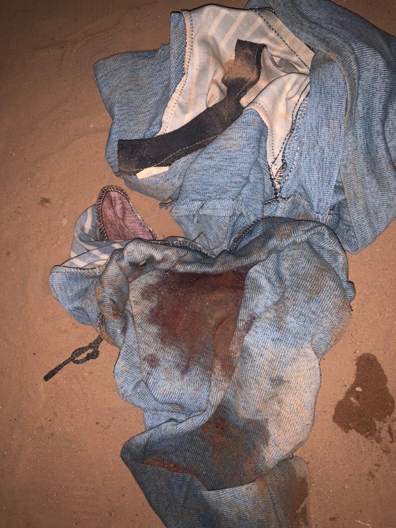 ModiMouna's tweet photo. Je viens d’être alertée par le cas urgent d’un petit enfant orphelin de père, âgé de 3 ans, dont la mère souffre d’une maladie mentale. 
Aujourd’hui, cet enfant fait face à une sévère forme d’hémorroïdes, au point que son anus est exposé et saigne constamment.

00227 84828179 https://t.co/OzuUAnNWTY