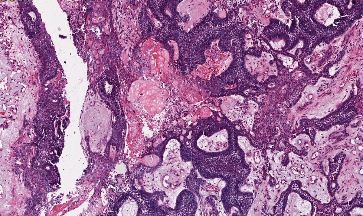 Dan Graham tweet media