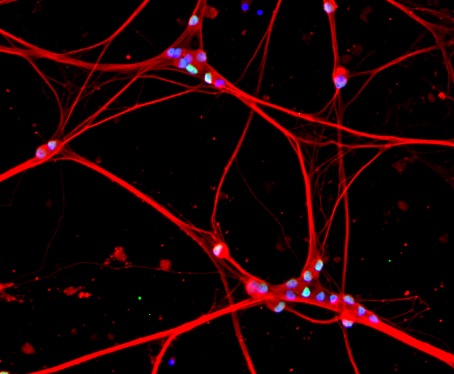 Cell Biology and Physiology at UNC (@unc_cbp) on Twitter photo āNeurons can reverse their decision to die from a point thatās considered impossible in most other cells,ā saidĀ <a href="/DeshmukhLab/">DeshmukhLab</a>. Read how neurons escape death below! Happy Halloween! med.unc.edu/cellbiophysio/⦠āNeurons can reverse their decision to die from a point thatās considered impossible in most other cells,ā saidĀ <a href="/DeshmukhLab/">DeshmukhLab</a>. Read how neurons escape death below! Happy Halloween! med.unc.edu/cellbiophysio/ā¦