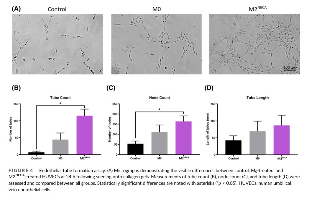 Ilaha Isali (@ilahaisali) on Twitter photo 🆕Excited to share our latest findings on macrophages. We explored different M2 macrophage subtype-specific cytokines affect fibroblast growth & endothelial cell function in co-culture systems 🧫🧪Link below👇onlinelibrary.wiley.com/doi/10.1002/jb… <a href="/WCMUrology/">Weill Cornell Medicine Urology</a> <a href="/Thomas_R_Wong/">Thomas Wong</a> <a href="/Phil_McClellan/">Phillip McClellan</a> 🆕Excited to share our latest findings on macrophages. We explored different M2 macrophage subtype-specific cytokines affect fibroblast growth & endothelial cell function in co-culture systems 🧫🧪Link below👇onlinelibrary.wiley.com/doi/10.1002/jb… <a href="/WCMUrology/">Weill Cornell Medicine Urology</a> <a href="/Thomas_R_Wong/">Thomas Wong</a> <a href="/Phil_McClellan/">Phillip McClellan</a>
