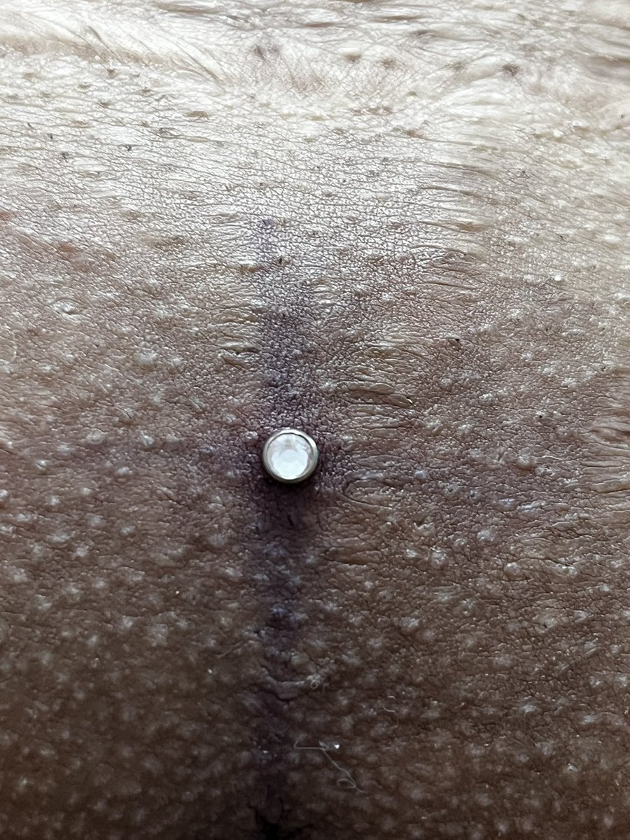 evandropiercer's tweet photo. Vamos de #microdermalgenital https://t.co/sNnBODFAKo