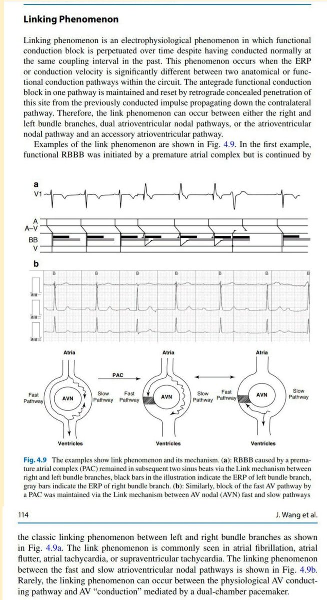 KostekMilan's tweet image. My final contribution to the linking phenomenon. Just click in the pic to read it fully.