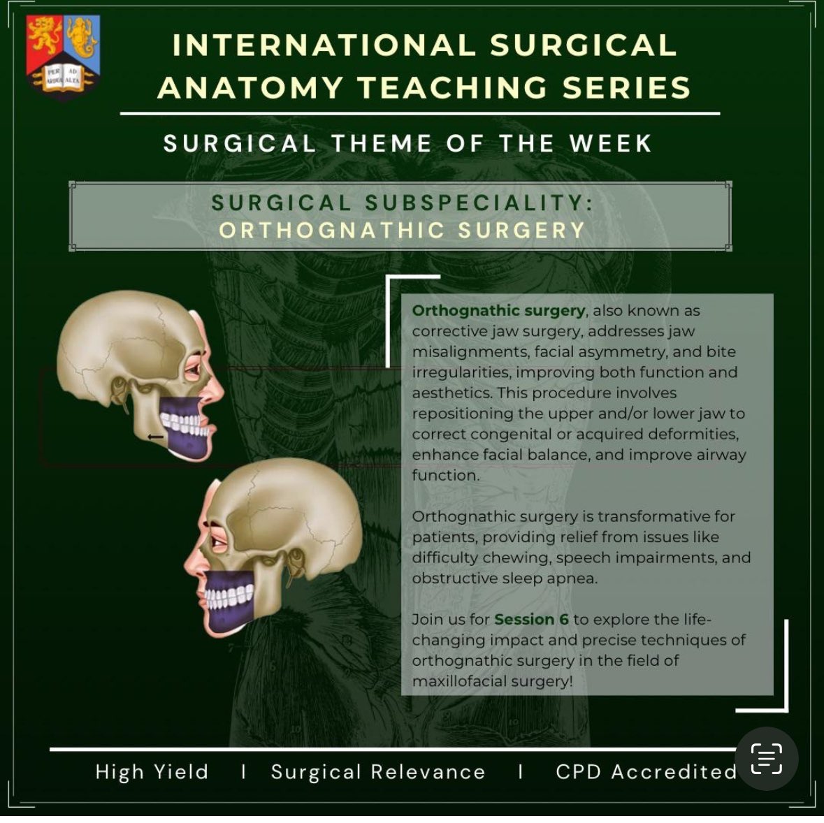 A different approach! 

Delivering an entirely #virtualreality anatomy lecture at the @International Surgical Anatomy Series 

demonstrating principles of 

facial fracture management
orthognathic surgery and
head and neck reconstruction with free tissue transfer 

and will be