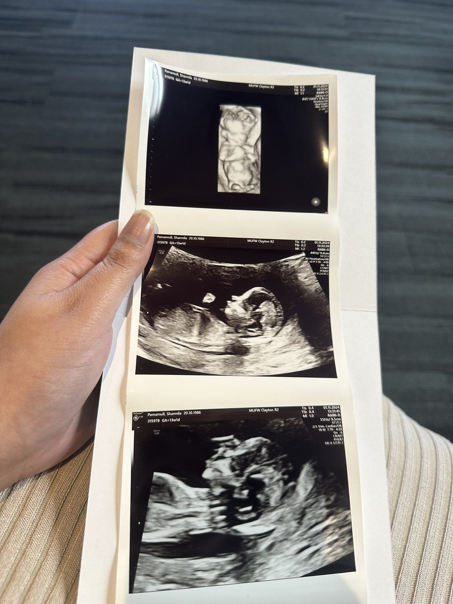 My little boy, 13 weeks and 1 day old