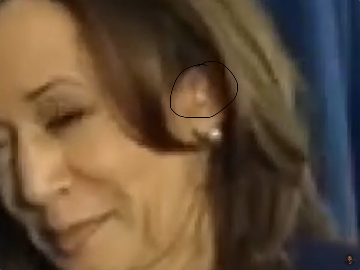 chappers2001's tweet photo. Ear piece? https://t.co/FikPL9uUzO