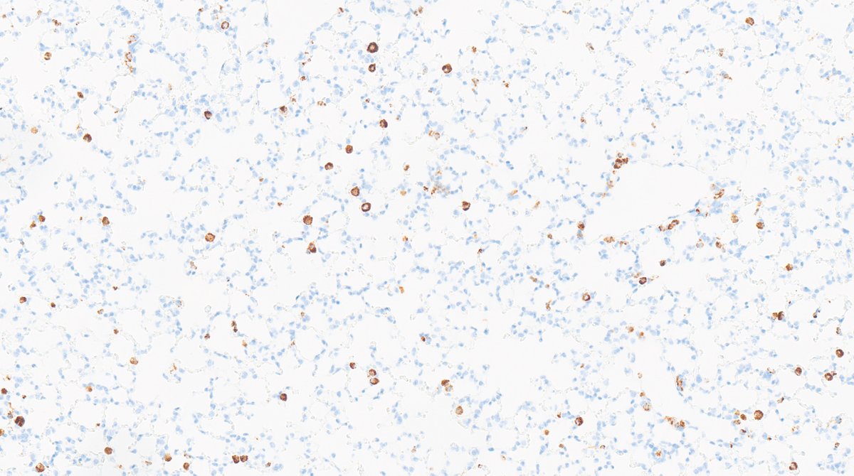 Department of Biomedicine (@depbiomedicine) on Twitter photo Congrats to <a href="/MomoBentires/">M. Bentires-Alj</a> and @BaumannZora for their new study in @CellReportsMethods! 🎉 They developed a full-spectrum flow cytometry panel to deeply and broadly immunophenotype highly autofluorescent lungs in healthy and lung metastasis-bearing mice. 👉shorturl.at/Y5YRa Congrats to <a href="/MomoBentires/">M. Bentires-Alj</a> and @BaumannZora for their new study in @CellReportsMethods! 🎉 They developed a full-spectrum flow cytometry panel to deeply and broadly immunophenotype highly autofluorescent lungs in healthy and lung metastasis-bearing mice. 👉shorturl.at/Y5YRa