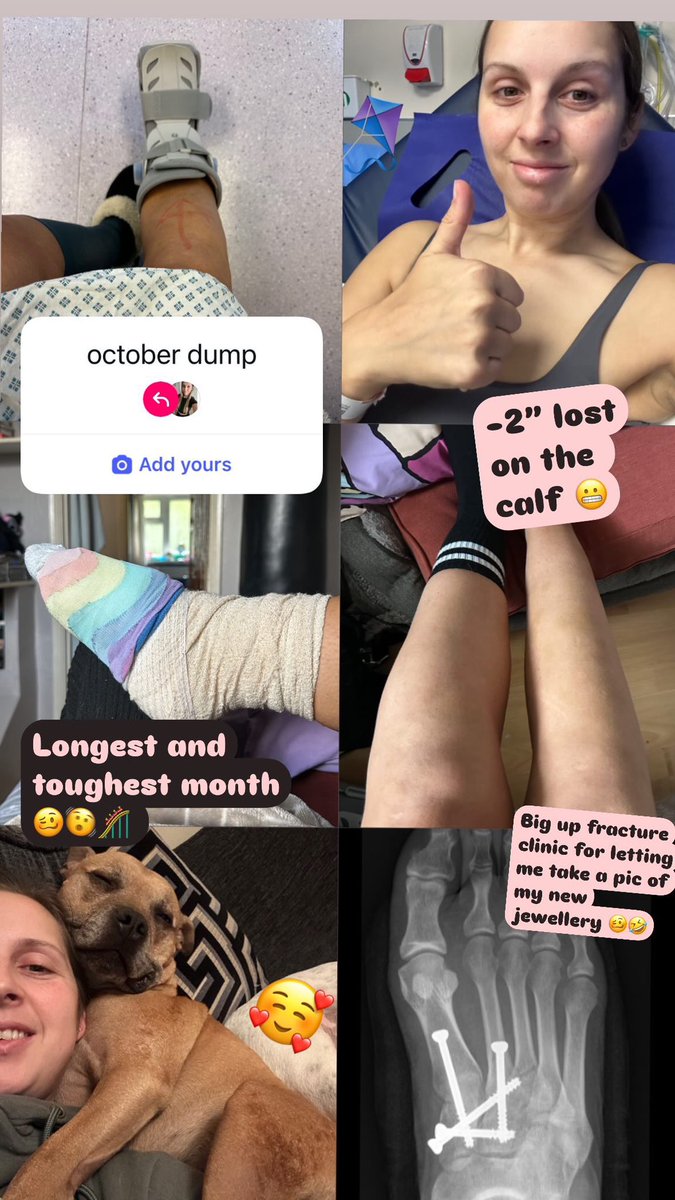 3.5weeks post Lisfranc ORIF surgery!
Its been a rollercoaster🎢 

Things I’ve learnt:
1. Living alone (no matter your age) doesn’t work in the first few weeks
2. Being young doesn’t stop you falling&amp; deconditioning😬
3. Take the analgesia!!
4. Its a journey&amp; its ok be emotional🙏🏽
