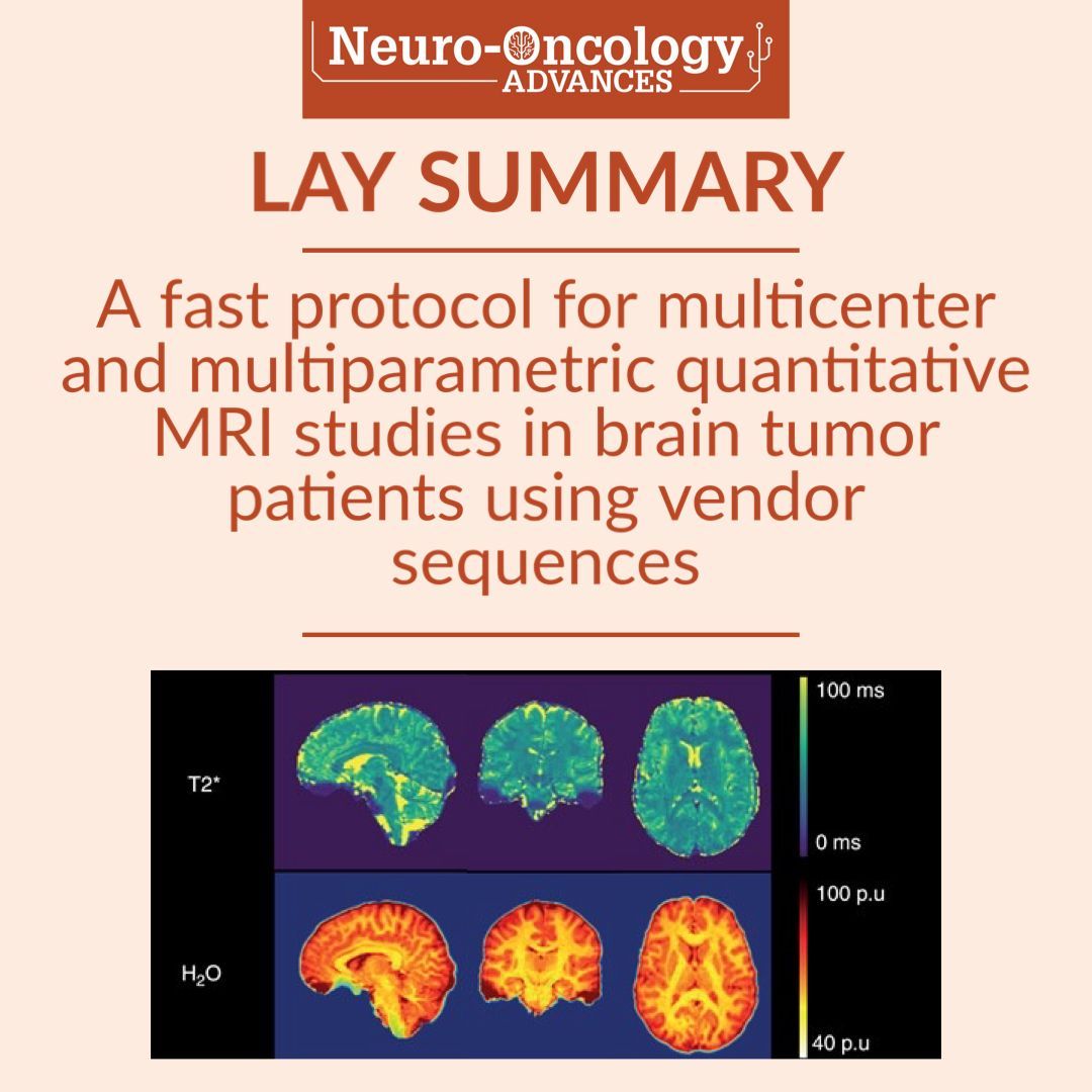EditorNeuro's tweet photo. Can we develop a shorter-duration #QuantitativeMRI method for #BrainTumors that could be used in the clinic without affecting the quality of results?
Read the latest #LaySummary or full open-access article: https://t.co/f64N1nOPRG
@gelarehzadeh @FarshadNassiri https://t.co/FmfzQgtzeb