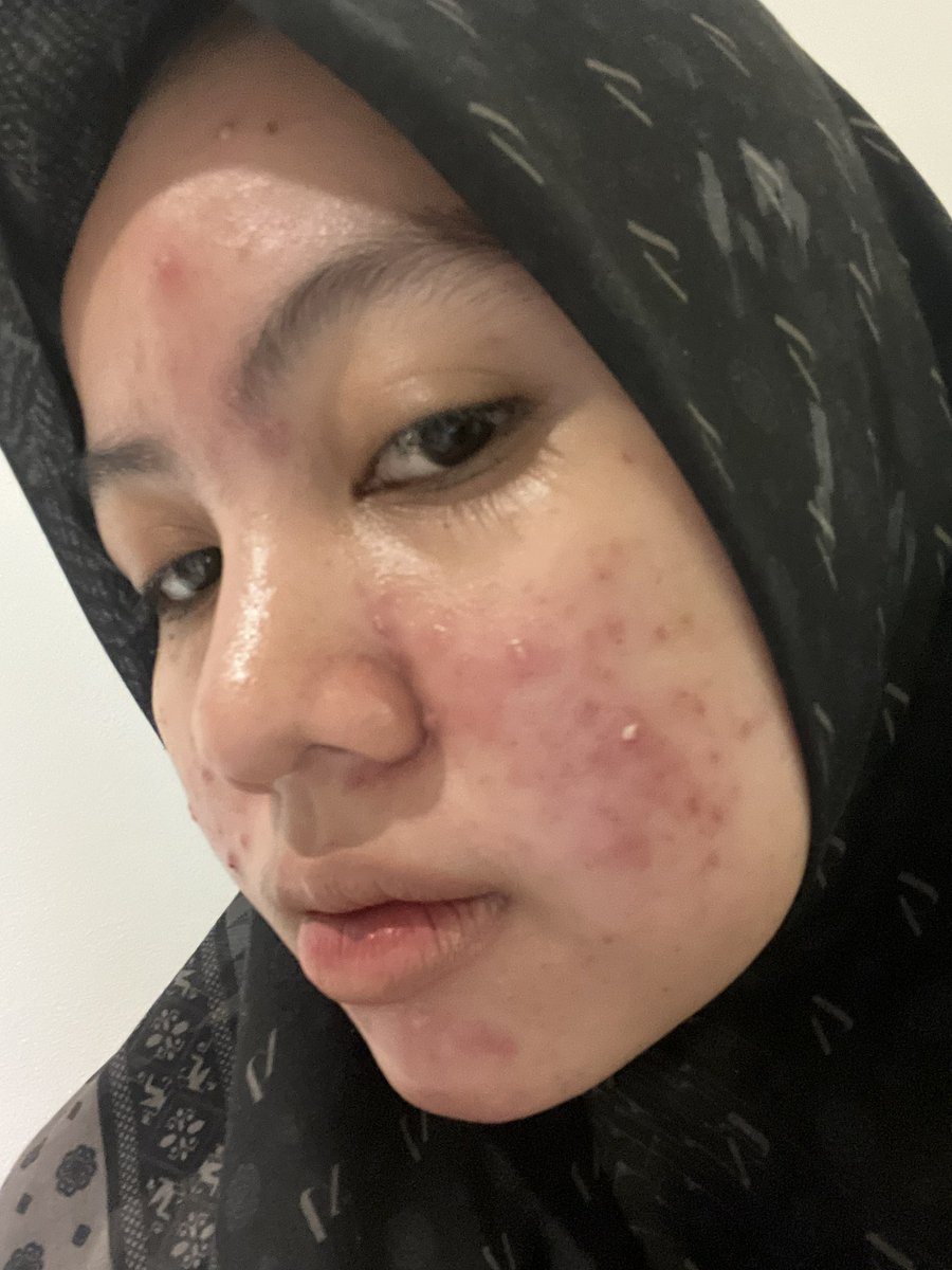 Dhiaz P Desectasari tweet media