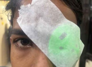 yespunjab's tweet photo. 21 patients, largely minors, reported at PGI Chandigarh with firecracker injuries
https://t.co/7qQvAqqrgL

#FirecrackerInjuries #DiwaliSafety #ChildInjuries #EyeTrauma #PublicHealth #EmergencyCare #PGIMER #Chandigarh https://t.co/OxHWQeynBb