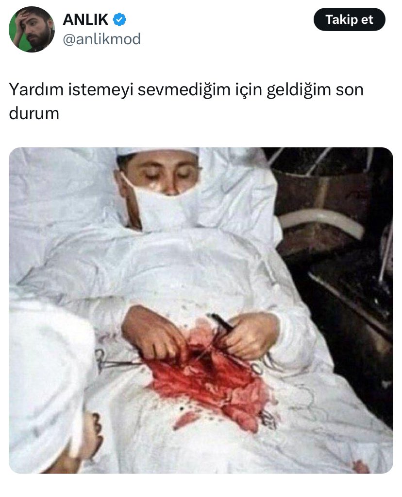 1yengecizm's tweet photo. Yengeç Burcu; https://t.co/WYewyCKLqE