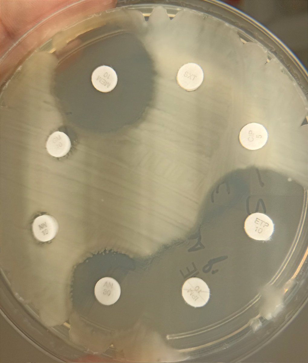 anderdemicro's tweet photo. Habrás oído que hace pocos días la FDA aprobó el uso de #Sulopenem etzadroxil probenecid, nuevo penem vía ORAL, como 💊 en ITUnc en♀️ por E. coli, K. pneumoniae y P. mirabilis difíciles de tratar, como este 👀
🦠 Klebsiella pneumoniae BLEE
🧫 Urocultivo
🤒♀️ ITU no complicada https://t.co/YJeIO3aKGj