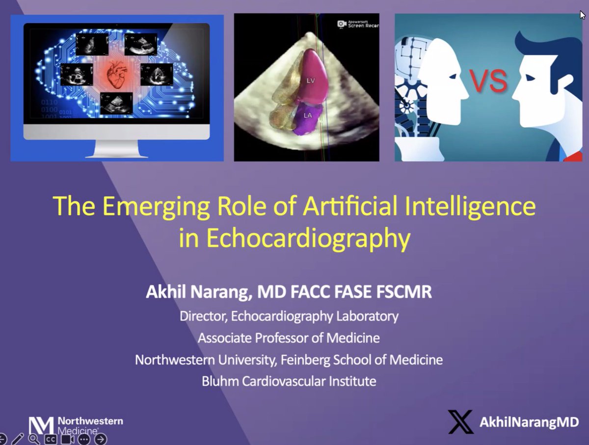 Stony Brook Department of Medicine (@sbudeptofmed) on Twitter photo Thank you <a href="/AkhilNarangMD/">Akhil Narang, MD</a> <a href="/NMCardioVasc/">NM Cardiovascular</a> for being our special guest speaker at this week's <a href="/StonyBrookMed/">Stony Brook Medicine</a> cardio grand rounds! #AI Thank you <a href="/AkhilNarangMD/">Akhil Narang, MD</a> <a href="/NMCardioVasc/">NM Cardiovascular</a> for being our special guest speaker at this week's <a href="/StonyBrookMed/">Stony Brook Medicine</a> cardio grand rounds! #AI