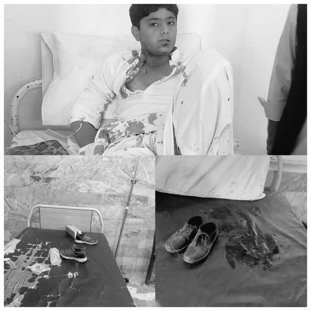 The tragic #Mastung incident reveals the cowardice of those opposing peace and education, targeting innocent children. Such acts threaten stability in #Balochistan, where safety is elusive for all. To achieve peace, we must unite against this violence.