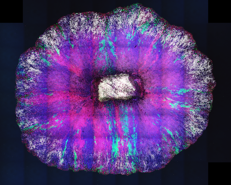 Gurdon Institute (@gurdoninstitute) on Twitter photo This striking image by <a href="/JoseAntonioVL/">Jose Antonio Valverde, phD</a> <a href="/AntoranLab/">AntoranLab</a> showcases the intricate details of the re-epithelialization process during wound healing and tissue regeneration in a mammalian oesophagus epithelioid model.
EdU (white, proliferation marker), Tomato (red) and GFP (green) labeling This striking image by <a href="/JoseAntonioVL/">Jose Antonio Valverde, phD</a> <a href="/AntoranLab/">AntoranLab</a> showcases the intricate details of the re-epithelialization process during wound healing and tissue regeneration in a mammalian oesophagus epithelioid model.
EdU (white, proliferation marker), Tomato (red) and GFP (green) labeling