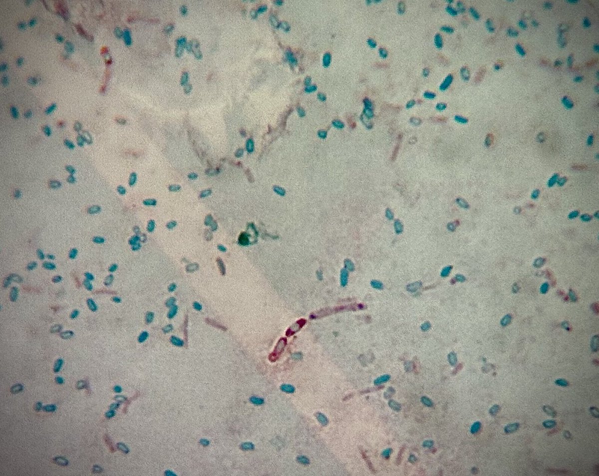 tasturm1's tweet image. #DescribeThatMicrobe a little, actually a lot, of spore action this Friday morning from Bacillus cereus. @ASMicrobiology #microbiology #science