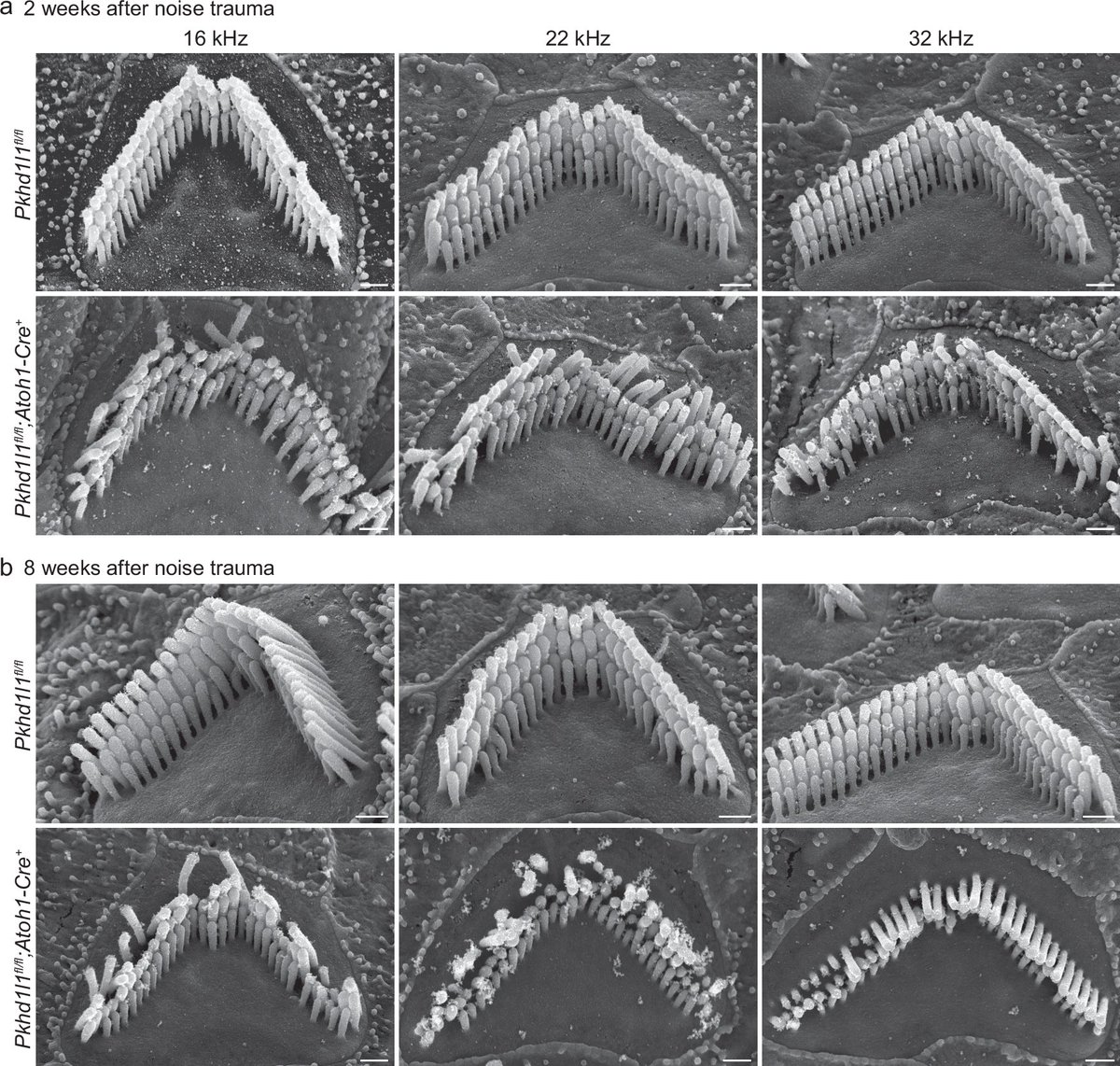 I am very excited to have this paper published, sharing new data on the recently established human deafness gene, DFNB124 (PKHD1L1)!
doi.org/10.1038/s42003…