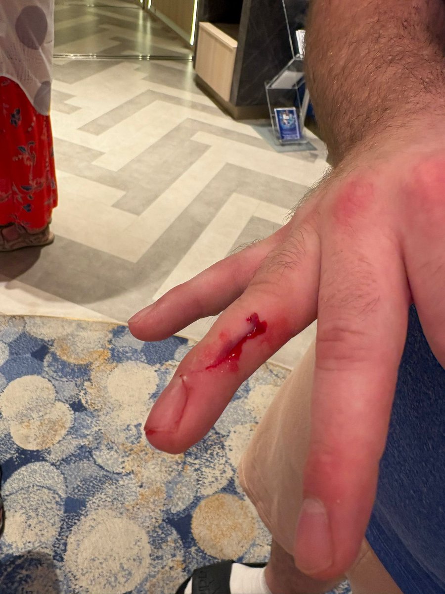 My brothers currently on #Arvia. He caught his finger as he picked up my niece outside the soft play area on broken marble. No signs have been put up since warn others, CS want him to pay £100+ to visit medical bay when it’s caused by their faulty facilities. Disgusting!
