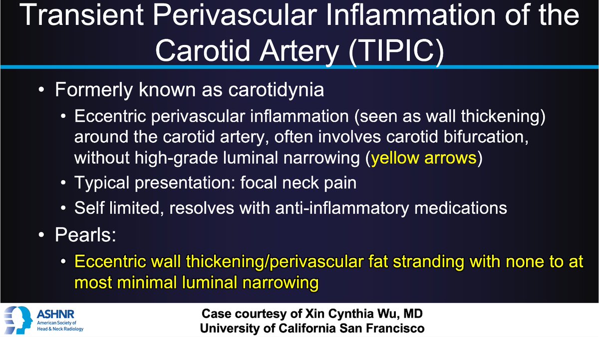 ASHNR (@ashnrsociety) on Twitter photo #ASHNRCOTW #274: ANSWER. Thx
<a href="/CynXinWu/">Cynthia Xin Wu</a> 4 case! #ASHNR25
<a href="/callyrobs/">Caroline Robson, MBChB</a> <a href="/DShatzkes/">Deborah Shatzkes</a> <a href="/CDP_Rad/">C Douglas Phillips 🇺🇸</a> <a href="/rhwiggins/">Richard Wiggins</a>
<a href="/nakoontz/">Nicholas Koontz</a> <a href="/KRileyMD/">Kalen Riley</a> <a href="/CMGlastonbury/">Christine M Glastonbury, MD</a> <a href="/tabby_kennedy/">Tabby A. Kennedy, MD</a> <a href="/PhilipRChapman1/">Philip R. Chapman, MD</a> <a href="/AshokSrini15/">Ashok Srinivasan</a>
@MohitAgNeurorad <a href="/amyfjuliano/">Amy Juliano</a> <a href="/bpoliceni/">Bruno Policeni</a> <a href="/kmmosier/">Kristine Mosier</a> <a href="/KatieTraylorDO/">Katie S. Traylor MS, DO, DABR</a> #ASHNRCOTW #274: ANSWER. Thx
<a href="/CynXinWu/">Cynthia Xin Wu</a> 4 case! #ASHNR25
<a href="/callyrobs/">Caroline Robson, MBChB</a> <a href="/DShatzkes/">Deborah Shatzkes</a> <a href="/CDP_Rad/">C Douglas Phillips 🇺🇸</a> <a href="/rhwiggins/">Richard Wiggins</a>
<a href="/nakoontz/">Nicholas Koontz</a> <a href="/KRileyMD/">Kalen Riley</a> <a href="/CMGlastonbury/">Christine M Glastonbury, MD</a> <a href="/tabby_kennedy/">Tabby A. Kennedy, MD</a> <a href="/PhilipRChapman1/">Philip R. Chapman, MD</a> <a href="/AshokSrini15/">Ashok Srinivasan</a>
@MohitAgNeurorad <a href="/amyfjuliano/">Amy Juliano</a> <a href="/bpoliceni/">Bruno Policeni</a> <a href="/kmmosier/">Kristine Mosier</a> <a href="/KatieTraylorDO/">Katie S. Traylor MS, DO, DABR</a>