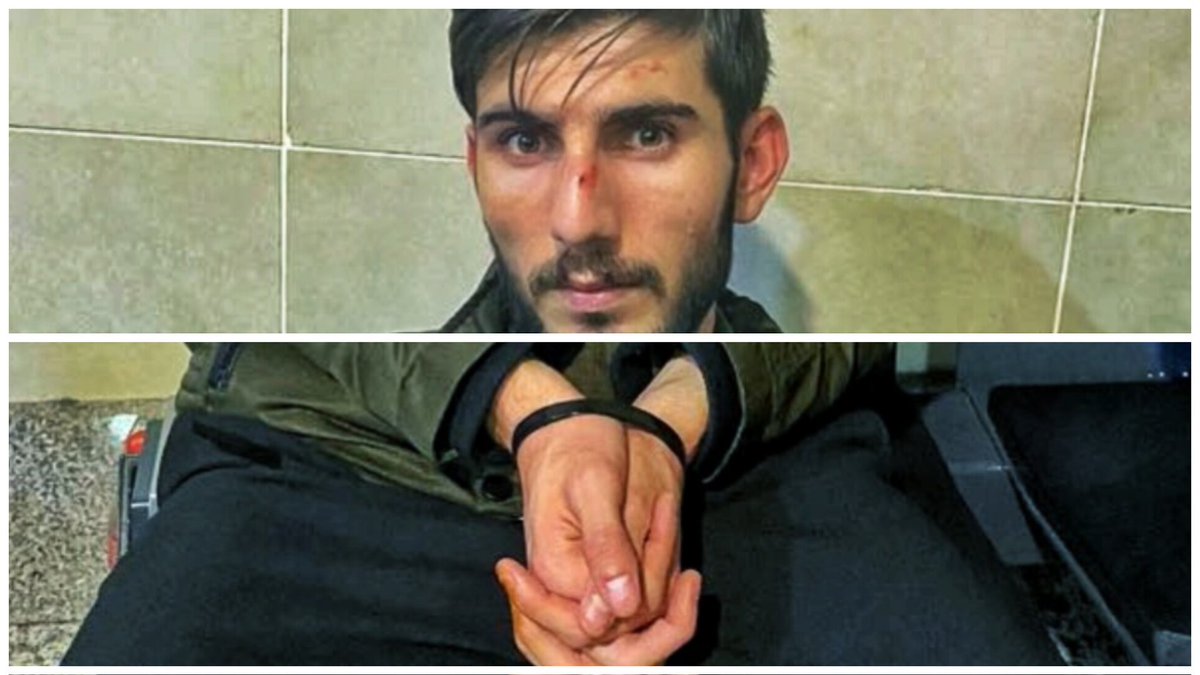 Ali Çeven'in yüzündeki bu yara ve ellerindeki plastik kelepçe, Kürd'ün Türkiye'deki itibarıdır işte.

Türklüğü kabul etmeyen ve ısrarla Kürt olduğunu ifade eden Kürtlere layık gördükleri şeydir bu. Sırf kendinden değil diye bu zulme sessiz kalanlarsa bu utancın bir parçasıdır!