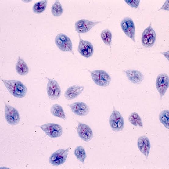 Stool microscopy image

What is it❓️

How do you treat❓️