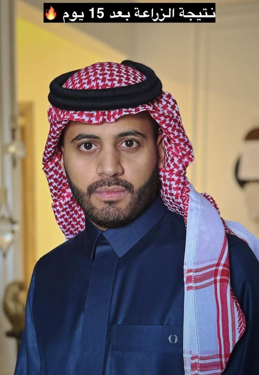 gorgeous4ew's tweet photo. متداول:

سبايكي قبل وبعد زراعة اللحية 😳! https://t.co/AhpF3Mq0pq