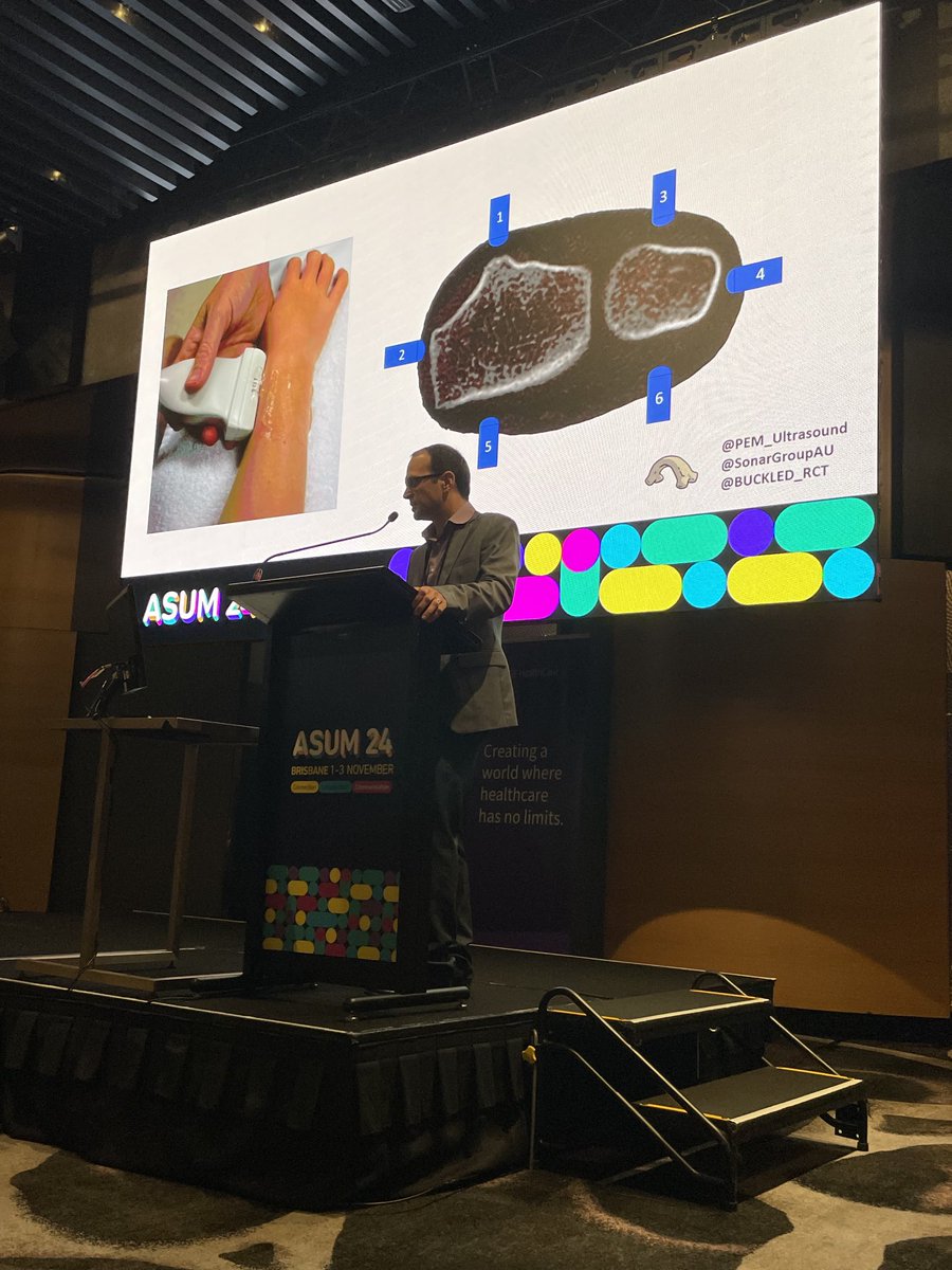 #ASUM24 update on US for forearm fracture detection in kids with ⁦<a href="/PEM_Ultrasound/">Peter Snelling</a>⁩ ⁦<a href="/SonarGroupAU/">SonarGroup.au</a>⁩ ⁦<a href="/BUCKLED_RCT/">BUCKLED Research</a>⁩ ⁦<a href="/asumultrasound/">ASUM</a>⁩
