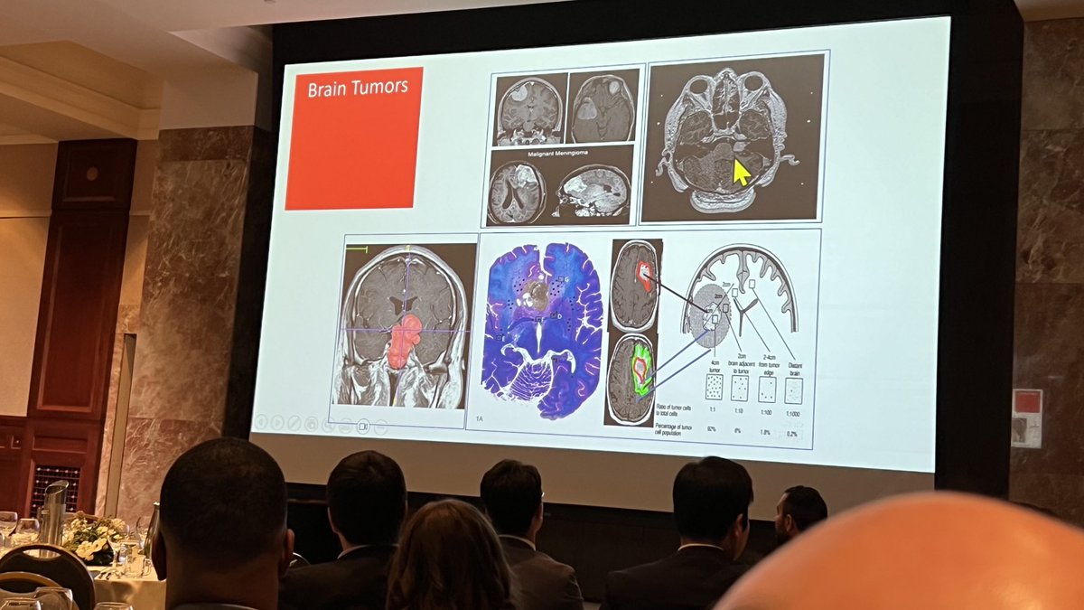 Robert Spinner, MD (@robspinnermd) on Twitter photo <a href="/exciting/">JØ</a> advances in brain tumors by <a href="/gelarehzadeh/">gelareh-zadeh</a>. So many opportunities for peripheral nerve tumors. Stay tuned. <a href="/MayoClinicNeuro/">Mayo Clinic Neuro</a> <a href="/YosefEllenbogen/">Yosef Ellenbogen</a> <a href="/lsyefet/">Leo Yefet</a> <a href="/ap_landry/">Alex Landry</a> <a href="/AndrewAjisebutu/">Andrew Ajisebutu</a> <a href="/UofTNeuroSurge/">University of Toronto Neurosurgery</a> <a href="/exciting/">JØ</a> advances in brain tumors by <a href="/gelarehzadeh/">gelareh-zadeh</a>. So many opportunities for peripheral nerve tumors. Stay tuned. <a href="/MayoClinicNeuro/">Mayo Clinic Neuro</a> <a href="/YosefEllenbogen/">Yosef Ellenbogen</a> <a href="/lsyefet/">Leo Yefet</a> <a href="/ap_landry/">Alex Landry</a> <a href="/AndrewAjisebutu/">Andrew Ajisebutu</a> <a href="/UofTNeuroSurge/">University of Toronto Neurosurgery</a>