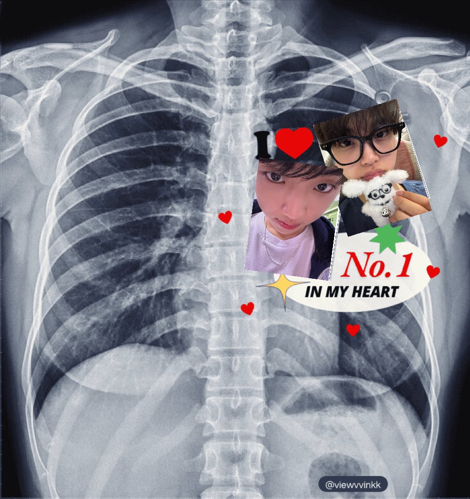 ㅇㅂㅇㅂ tweet media