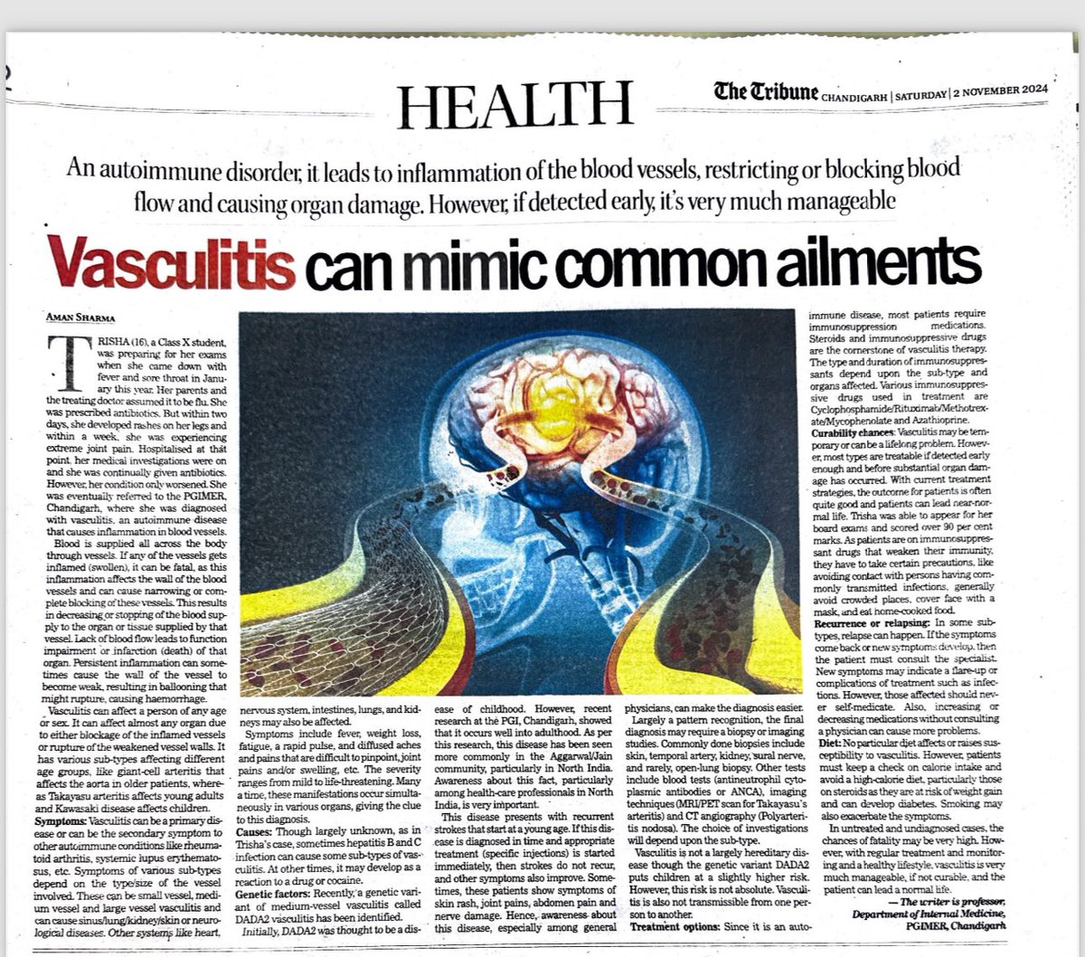 Amansharmapgi's tweet photo. Vasculitis can sometimes mimic common ailments. Timely diagnosis is the key. We need more awareness both amongst physicians and public. https://t.co/7yFdh2Pqh3 https://t.co/BXro2gynST