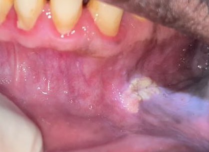 عبدالله tweet media