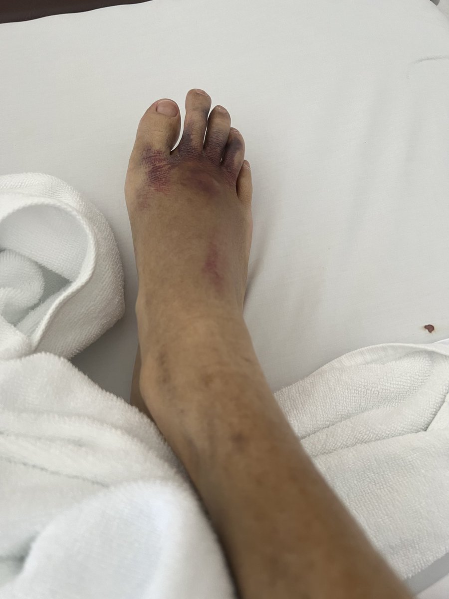 เจ้าเซื่อเรื่องการเน่าในบ่