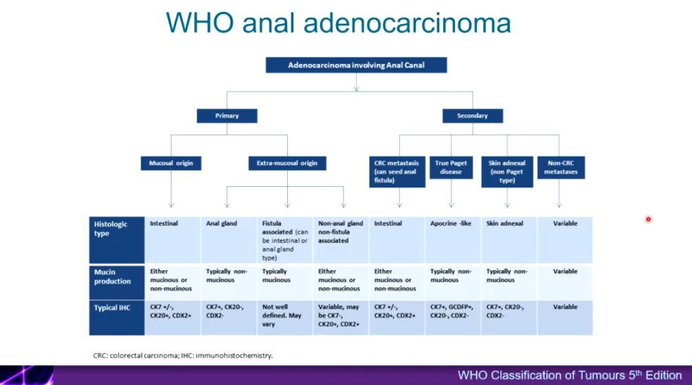 WHO Anal Adenocarcinoma classification 5th edition 

Dr. Zhang #CAP24 #pathology #pathologist #pathX #PathTwitter #pathresidents #pathfellows