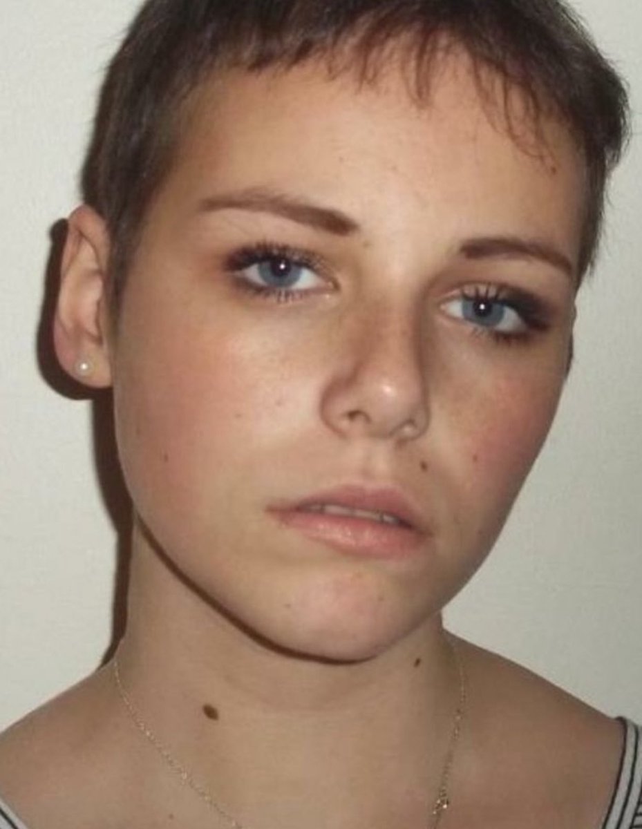 alexeades1's tweet image. I’ve been trying to raise awareness of brain cancer and my late daughters journey with a grade 4 glioblastoma- no cure. I normally don’t ask for followers but I would so like to hit 16,000 a RT would be much appreciated. With thanks from a bereaved mother.
Charlotte 18.2.97 -…