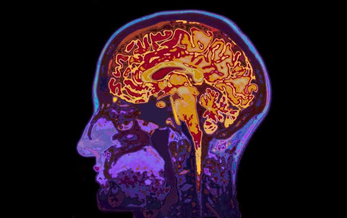 🚨 Última hora 🚨

Científicos reportan el primer caso mundial de Alzheimer en un paciente de 19 años 😨👇