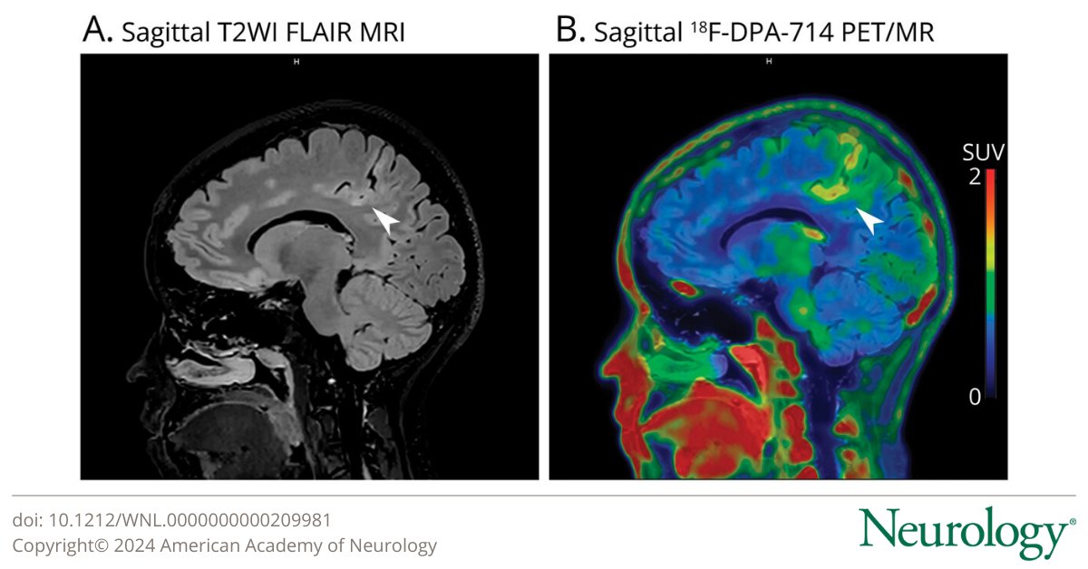 Neurology Journal tweet media