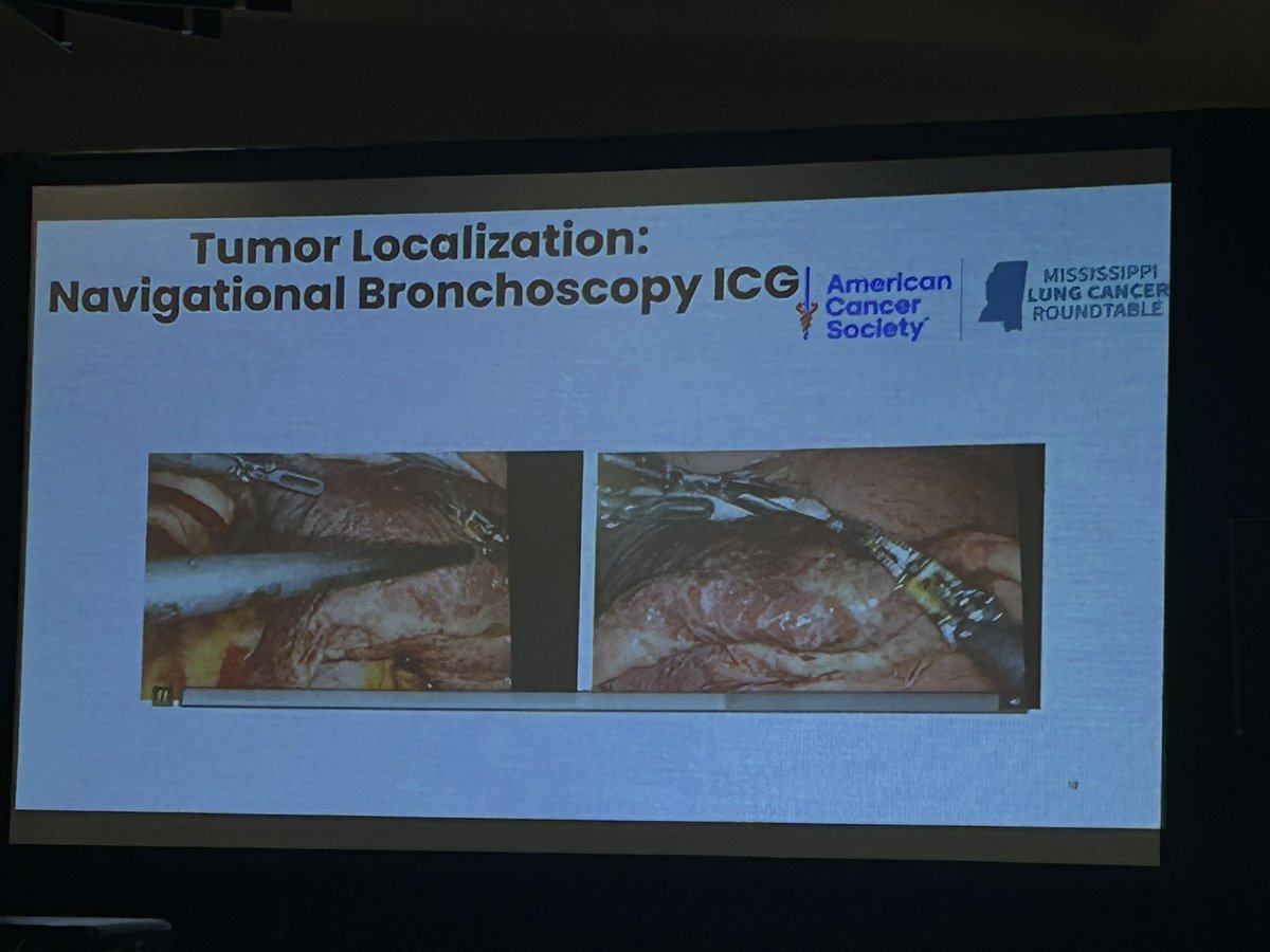 Mississippi Lung Cancer Roundtable tweet media