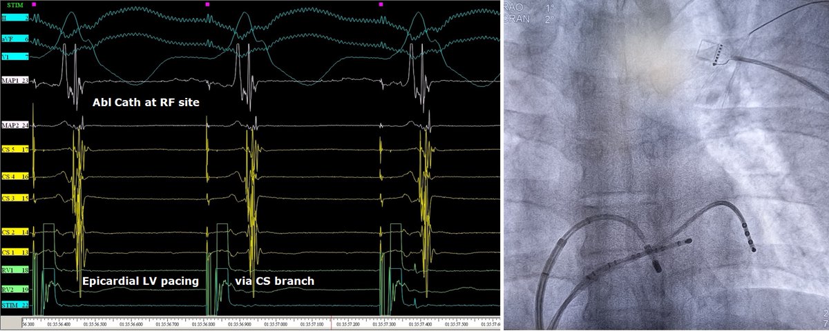 Giovanni Coluccia tweet media