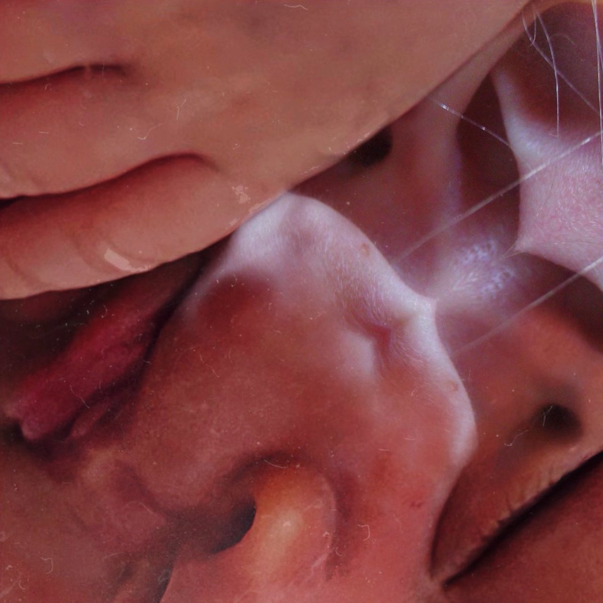 vellar_skin's tweet photo. New single out now 

https://t.co/gonV1VOn3X https://t.co/dM5I5T92jO