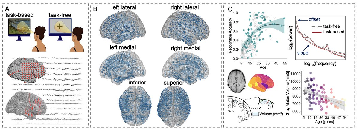 Very excited to share the first paper of my postdoc at <a href="/NUFeinbergMed/">Northwestern Feinberg School of Medicine</a> on the development of aperiodic neural activity using iEEG in over 100 patients aged 5 - 54 years!