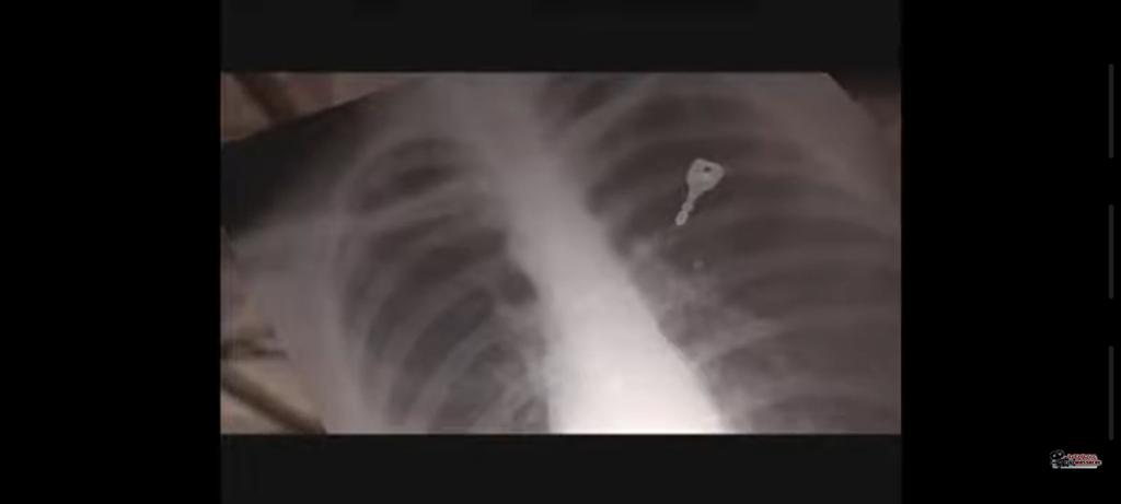 bloodybeautymfx's tweet image. Someone must&apos;ve slept near Jigsaw&apos;s house. #svengoolie #TheAbominableDrPhibes